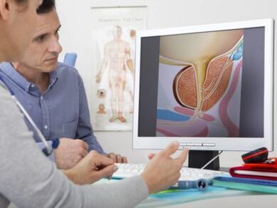 Урологът консултира пациента относно простатита и методите за неговото лечение.